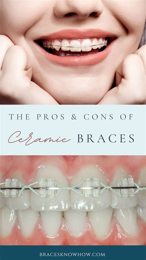 disadvantages ceramic braces vs metal